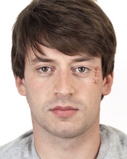 Man's face with scar next to eye